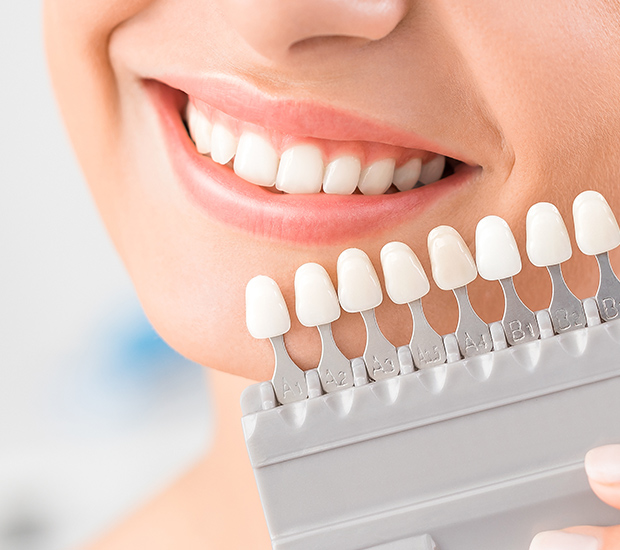 North Hills Dental Veneers and Dental Laminates